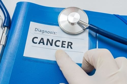 How to Navigate a Cancer Diagnosis
